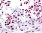 HMG1 / HMGB1 Antibody (clone 1D5)